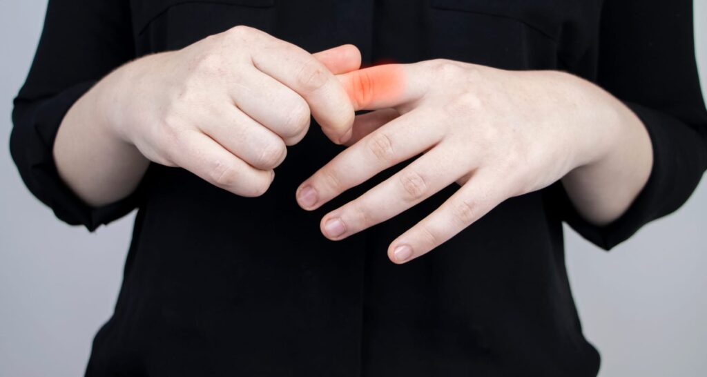 Miglior integratore per artrosi delle mani