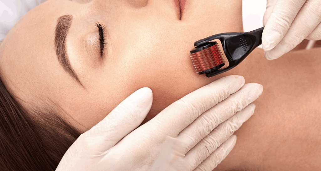 Miglior Derma Roller